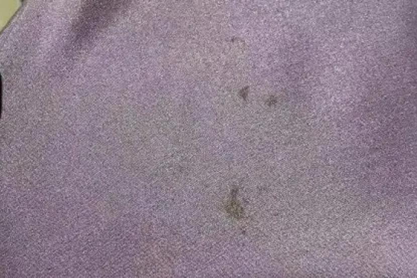 color stains disperse dyes